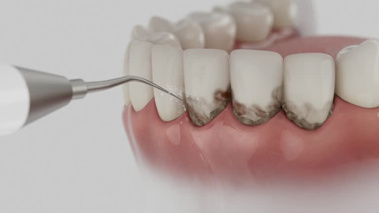 Reliable Dental contractor in Battle Ground, IN by Dentist Open Now